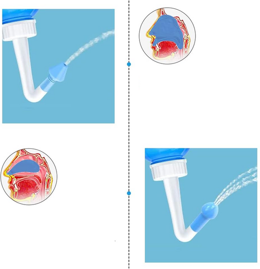 HOUDIAN Neti Poti irygator do nosa dla dzieci i dorosłych 2 końcówki 300 ml