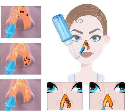 HOUDIAN Neti Pot irrigateur nasal pour enfants et adultes 2 embouts 300 ml